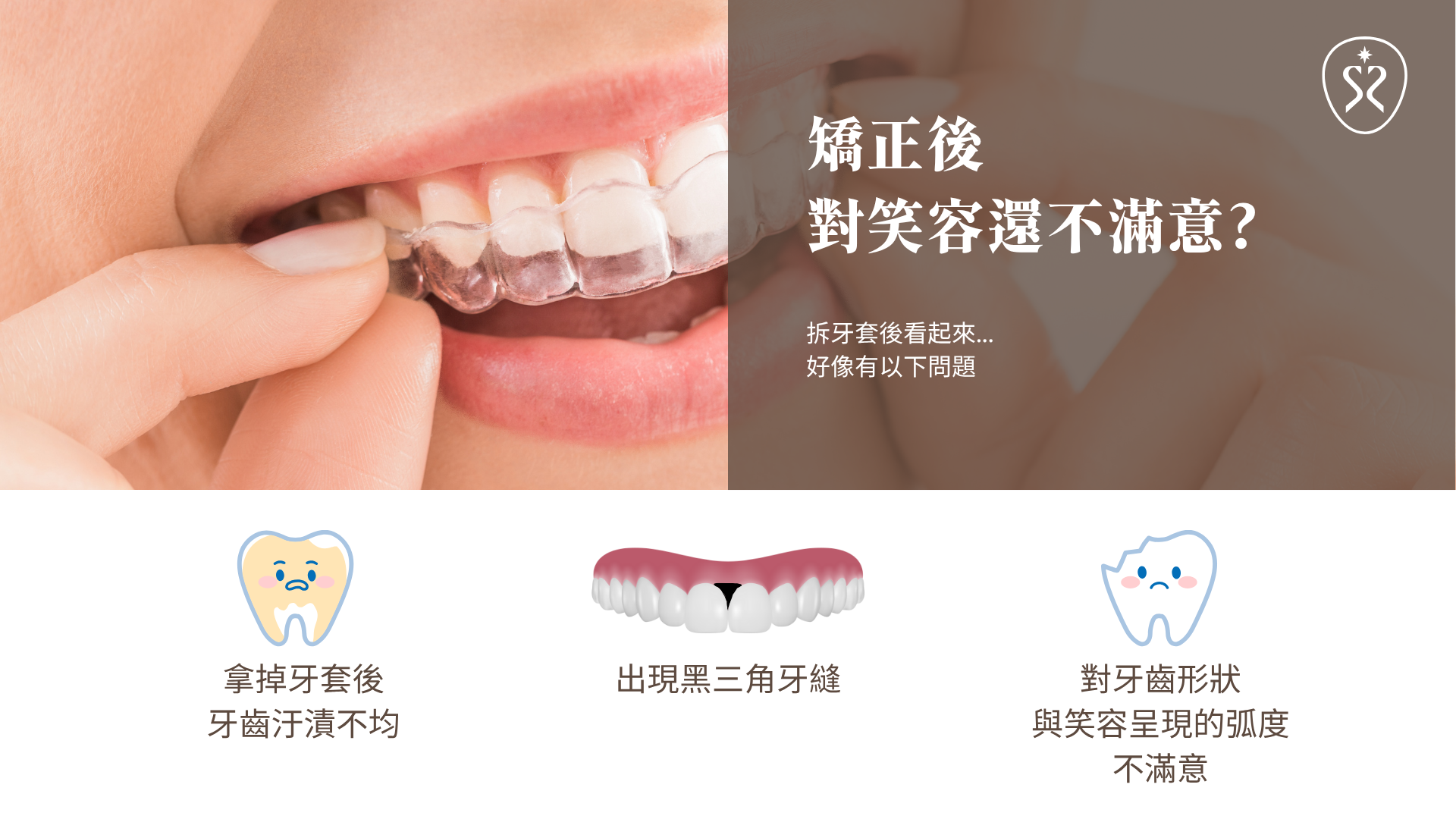 我有矯正牙齒後遺症嗎？笑容看起來不夠滿意...